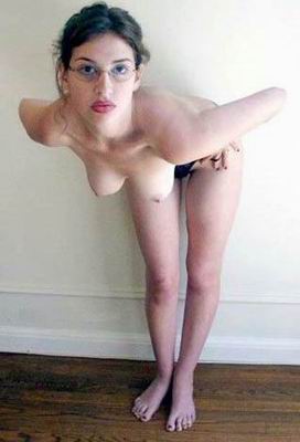 bald_fanny
